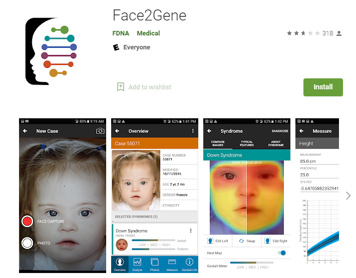 Face2Gene-face-recognition-app